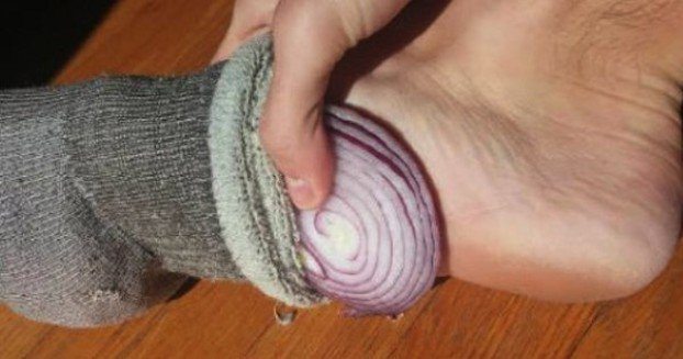 onion-socks-622x327